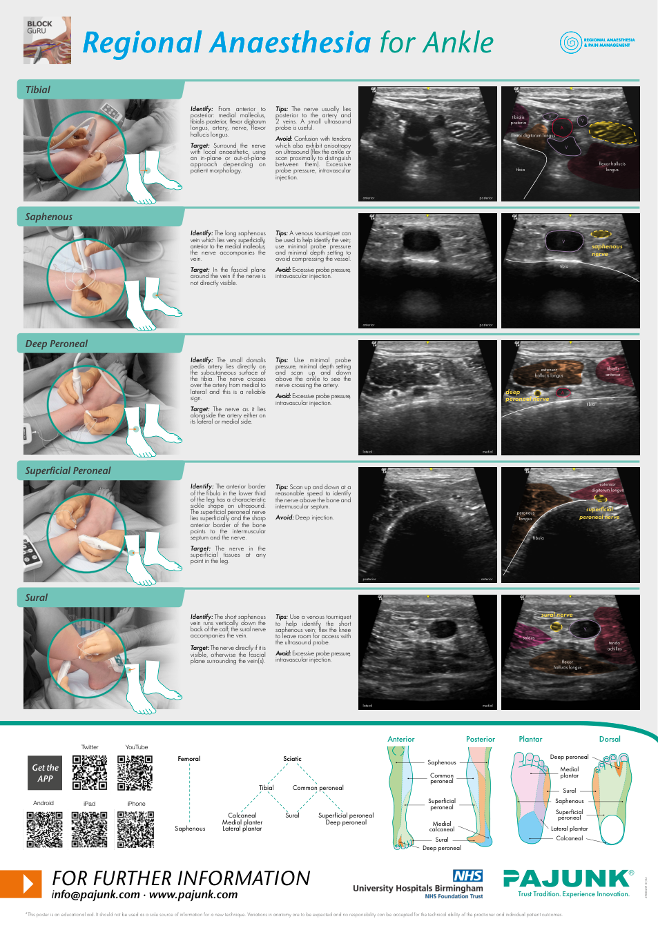 Ankle regional anesthesia poster