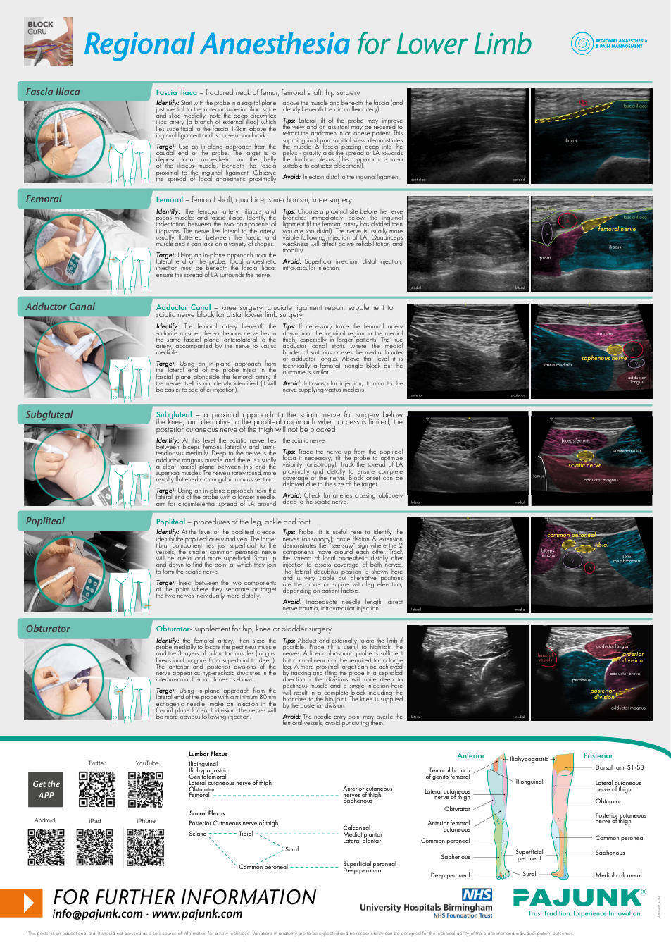 Lower limb regional anesthesia poster