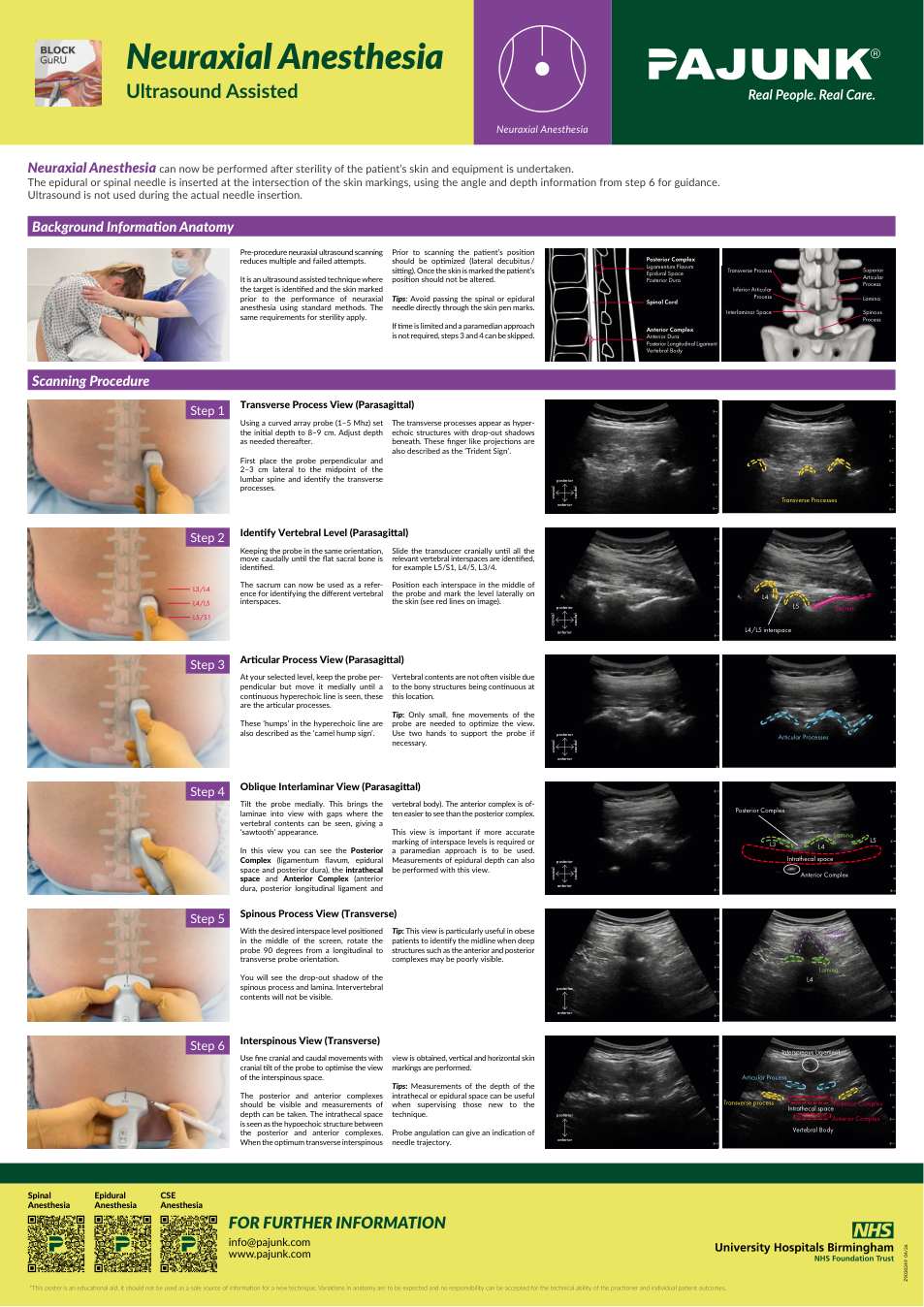 Neuraxial regional anesthesia poster