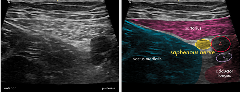 Original ultrasound panel from the Lower limb poster