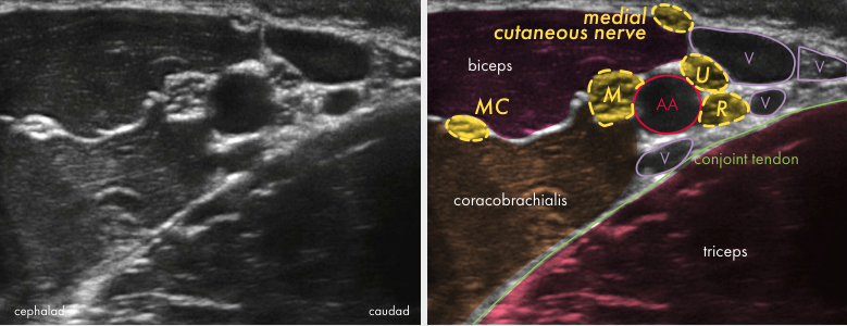 Original ultrasound panel from the Upper limb poster
