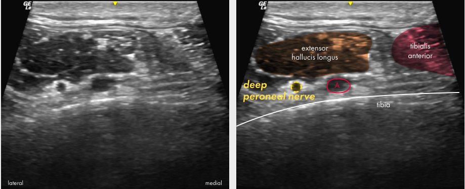 Original ultrasound panel from the Ankle poster