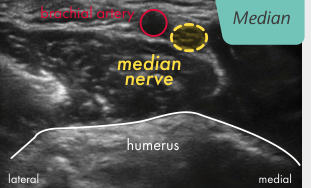 Original ultrasound panel from the Upper limb poster