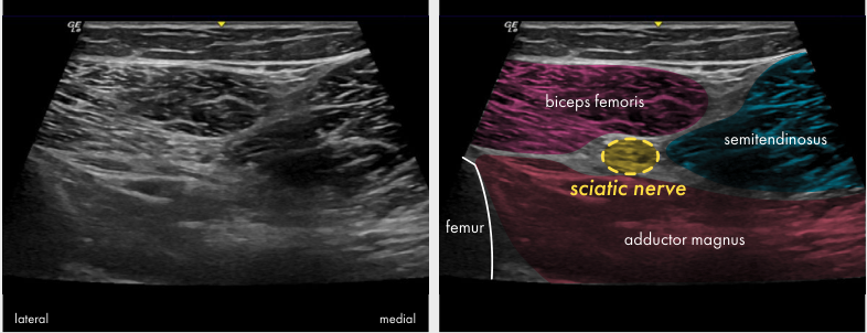 Original ultrasound panel from the Lower limb poster