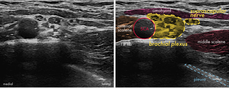 Original ultrasound panel from the Upper limb poster