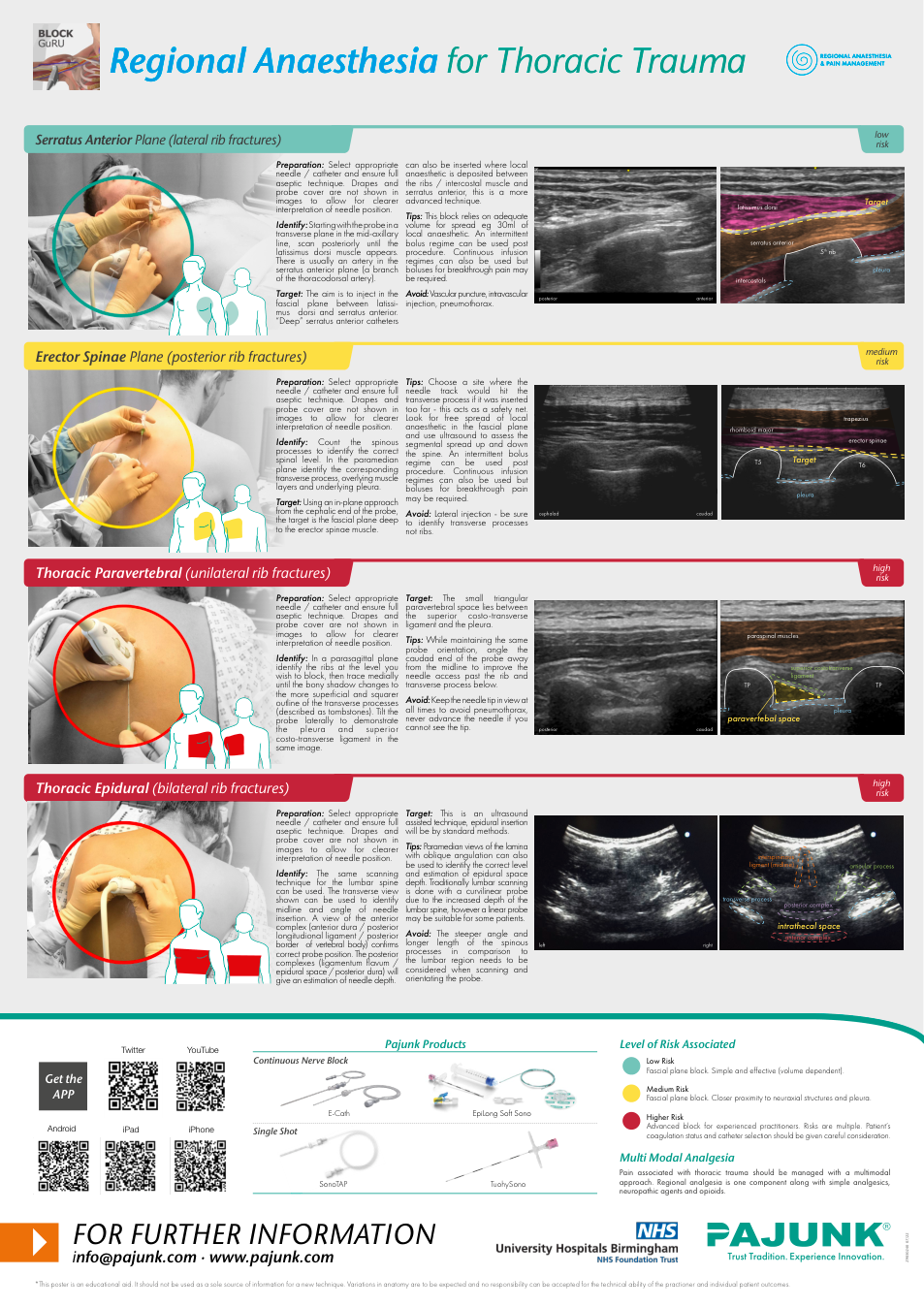 Thoracic regional anesthesia poster