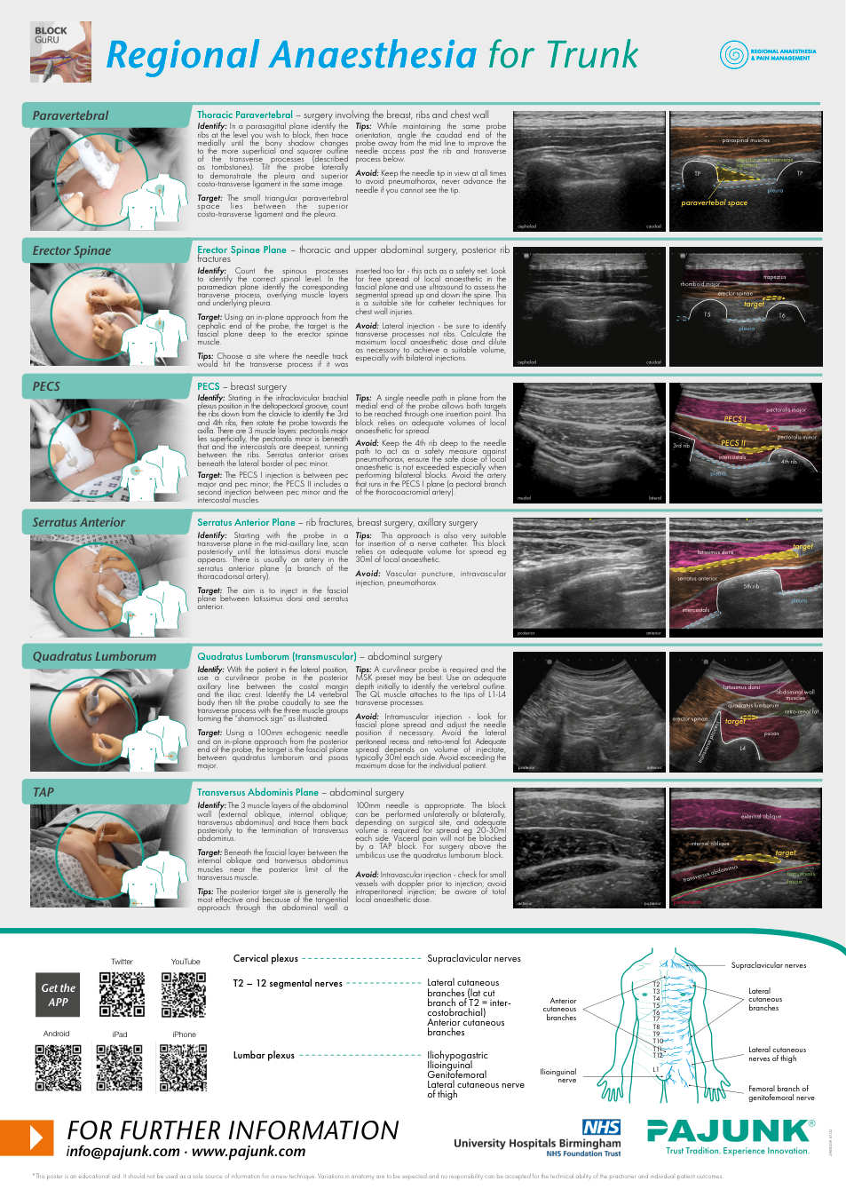 Trunk regional anesthesia poster